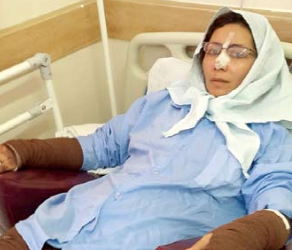 اسیدپاشی هولناک مادر روی دخترش اسیدپاشی هولناک مادر روی دخترش