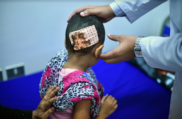 (تصاویر) 40 روز جنگ در یمن (تصاویر) 40 روز جنگ در یمن