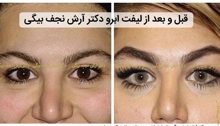 5 راه سریع رسیدن به ابروهای جذاب و خوش فرم