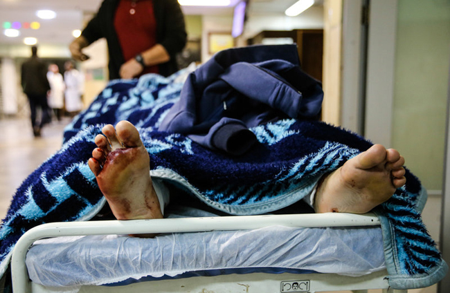 (تصاویر) مصدومان حادثه ی انفجار بازار تهران (تصاویر) مصدومان حادثه ی انفجار بازار تهران