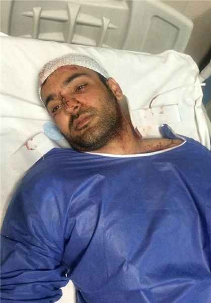 حادثه دلخراش برای ملی پوش دوچرخه سواری ایران در کرمان حادثه دلخراش برای ملی پوش دوچرخه سواری ایران در کرمان