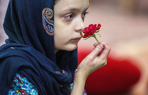 (تصاویر) این کودکان با چرک و زخم زندگی میکنند (تصاویر) این کودکان با چرک و زخم زندگی میکنند