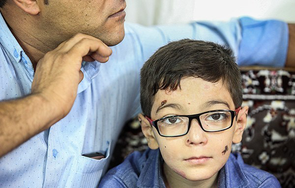 (تصاویر) این کودکان با چرک و زخم زندگی میکنند (تصاویر) این کودکان با چرک و زخم زندگی میکنند