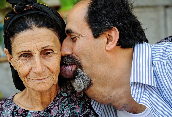 (تصاویر) بیماری دردناک اسماعیل (تصاویر) بیماری دردناک اسماعیل