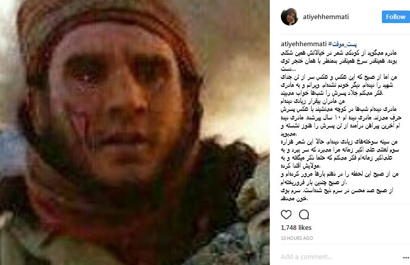 (تصاویر) یه دهه هفتادی با ژن خوب! //در حال تکمیل (تصاویر) یه دهه هفتادی با ژن خوب! //در حال تکمیل
