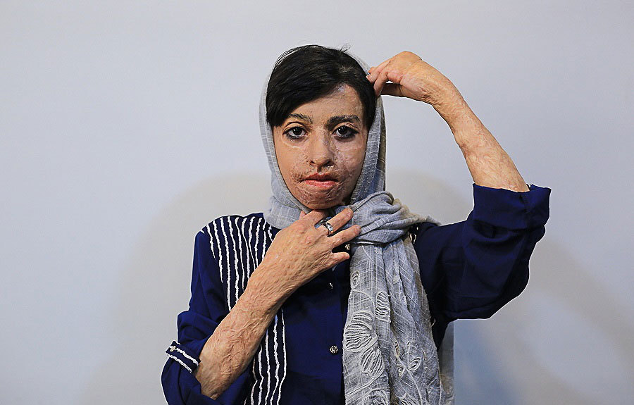 ۳۶۰ جراحیِ بی‌نتیجه روی دختران شین‌آبادی