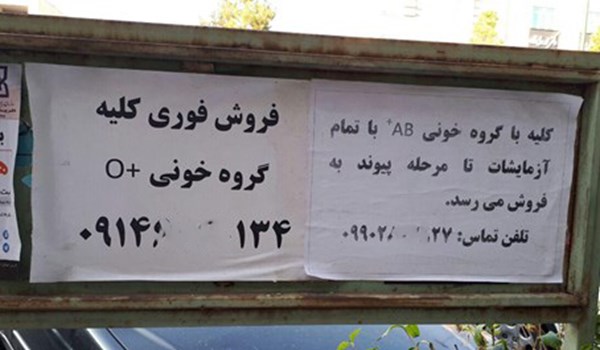 دلالی اعضای بدن در یزد دلالی اعضای بدن در یزد