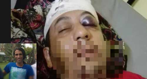 (تصویر) حمله به پناهجوی ایرانی در استرالیا