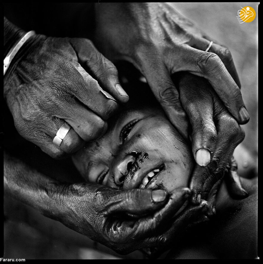 (تصاویر) رسم دلخراش زخم‌آرایی