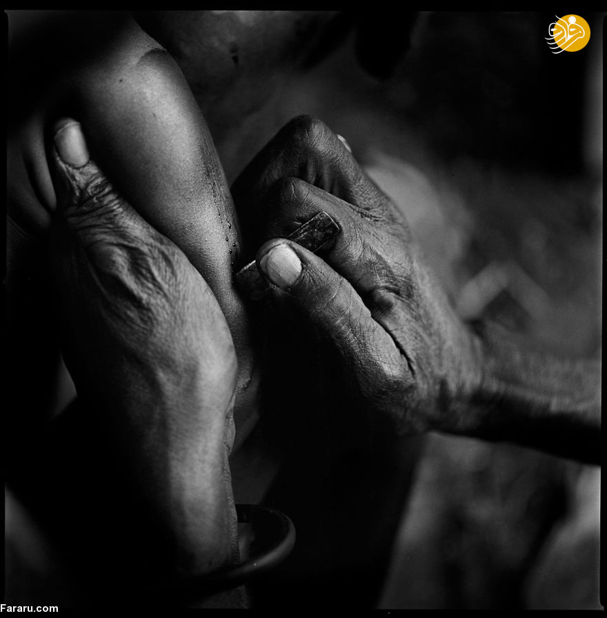 (تصاویر) رسم دلخراش زخم‌آرایی