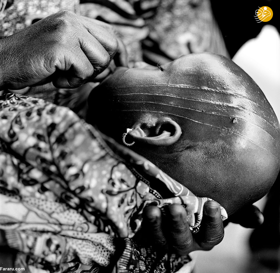 (تصاویر) رسم دلخراش زخم‌آرایی