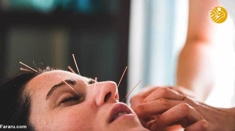 طب سوزنی چیست؟