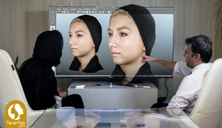 تفاوت جراحی بینی به روش باز و بسته