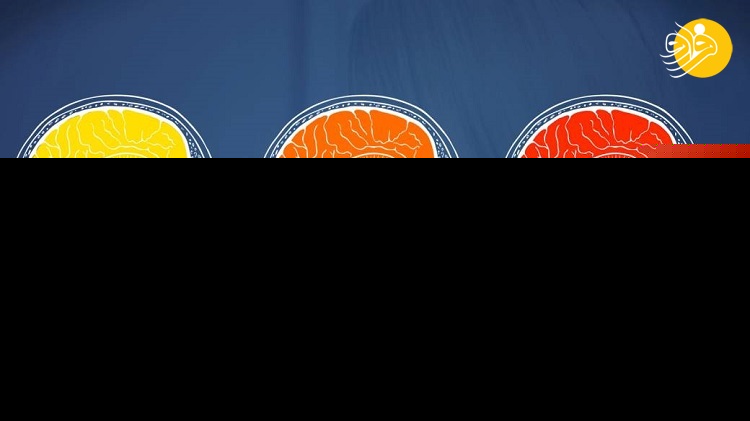 تاثیر استرس مزمن بر کیفیت زندگی تاثیر استرس مزمن بر کیفیت زندگی