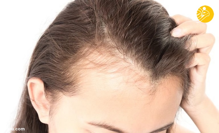دلایل رایج ریزش مو در تابستان و پاییز چیست؟ دلایل رایج ریزش مو در تابستان و پاییز چیست؟