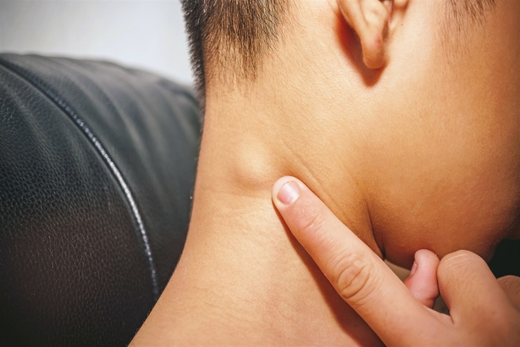 غدد لنفاوی چرا متورم میشوند؟ غدد لنفاوی چیست و چرا متورم میشود؟