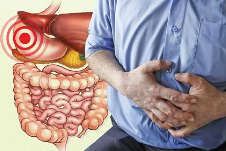 علل ایجاد دل پیچه چیست؟ دل پیچه؛ علت، نشانهها و راههای درمان آن