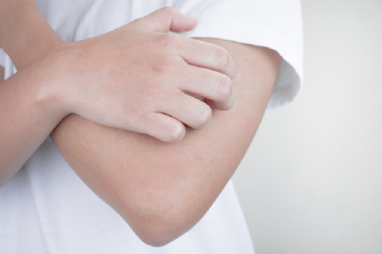 هرآنچه درباره قارچ‌های پوستی باید بدانید