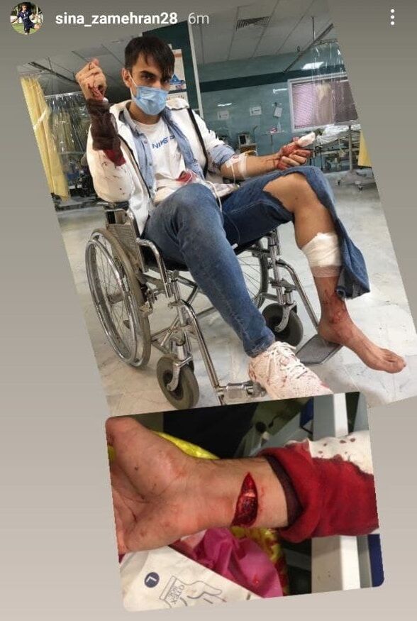 (عکس) جراحت شدید و دلخراش بازیکن پدیده