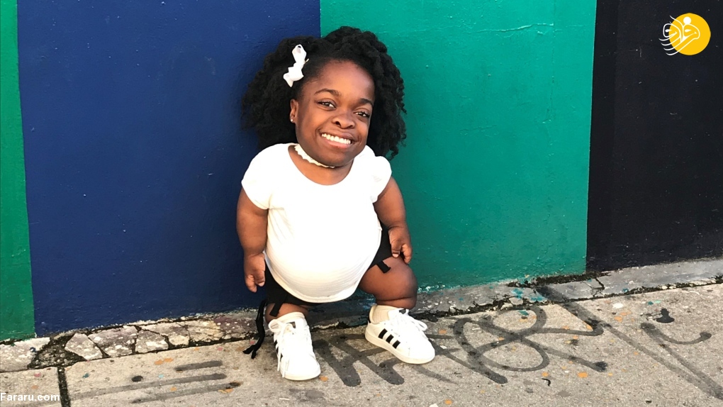 (تصاویر) کوتاه قدترین زن جهان