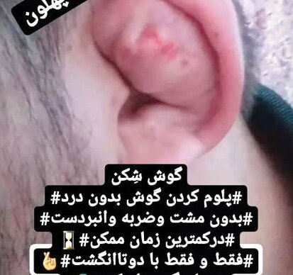 آگهی شکستن گوش