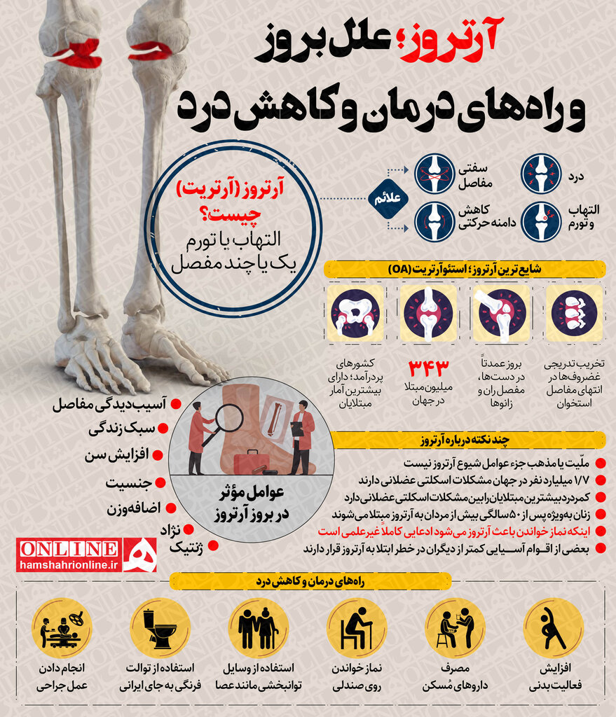  آرتروز