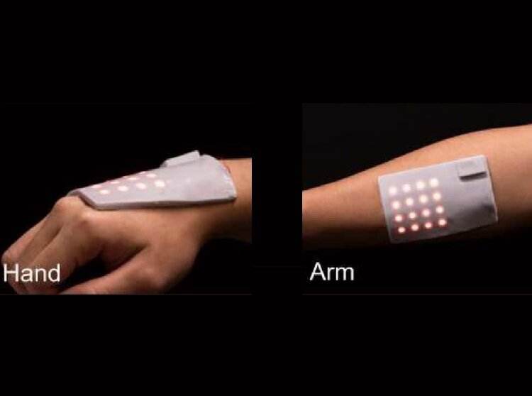 پوست الکترونیک