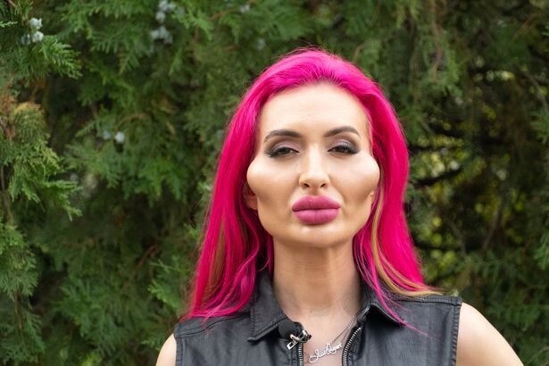 بزرگترین گونه