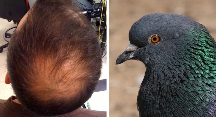 با ۱۰ مورد از عجیب‌ترین ترند‌های زیبایی تاریخ آشنا شوید