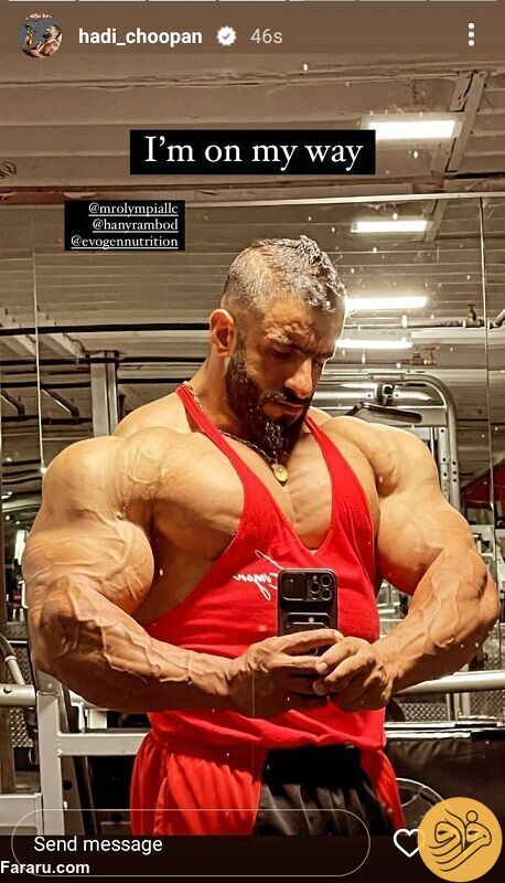 (عکس)تصویری غافلگیرکننده از مدل موهای هادی چوپان