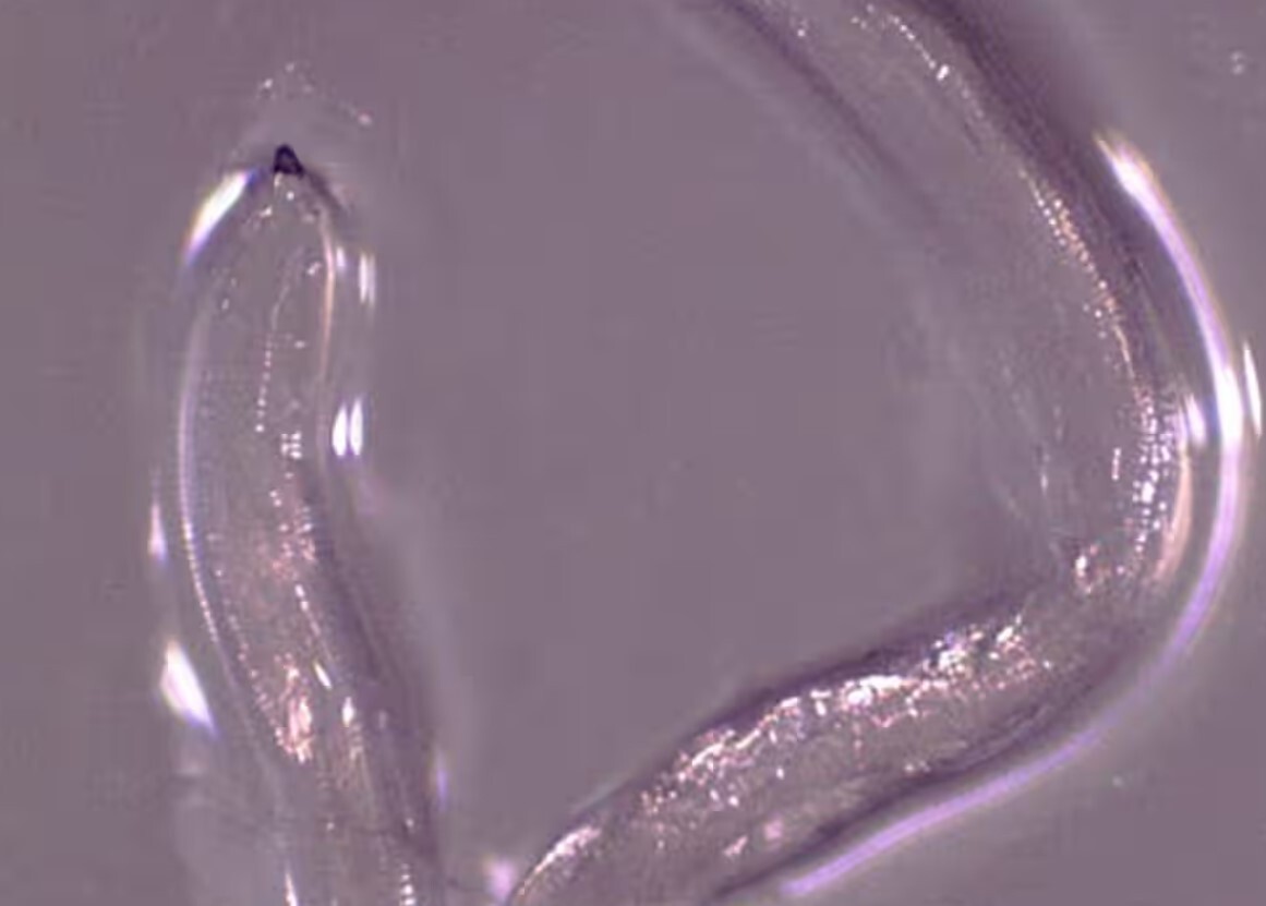 از کرم ریه تا سوسک سیگار، این موجودات در شما لانه سازی می‌کنند؟