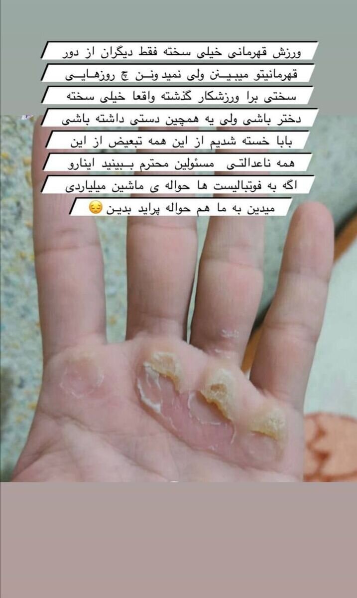 (عکس) حمله تند بانوی ملی پوش به کنعانی‌زادگان