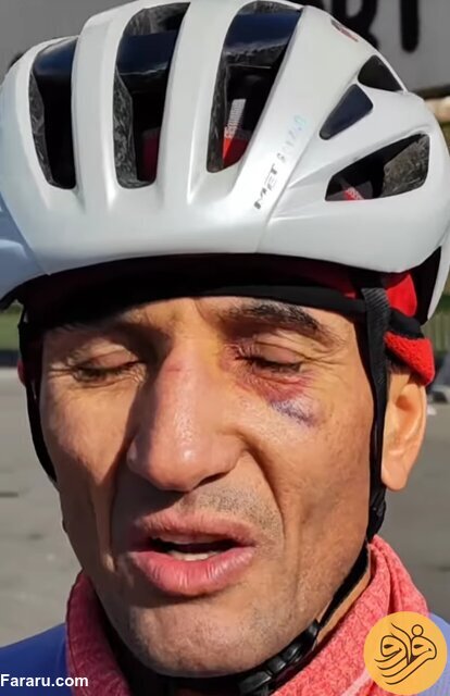 (عکس) حمله با پنجه بوکس به دوچرخه‌سوار ایران