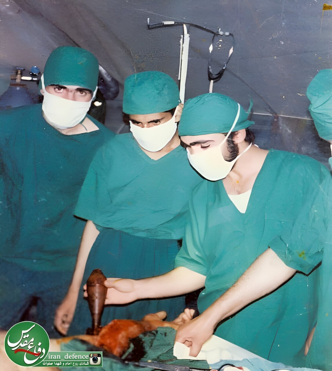 (عکس) خنثی کردن خمپاره ۶۰ در اتاق عمل