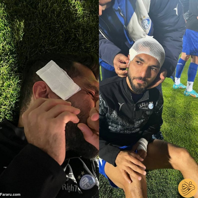 (عکس) پرسپولیسی‌ها با سنگ سر هافبک استقلال را شکستند