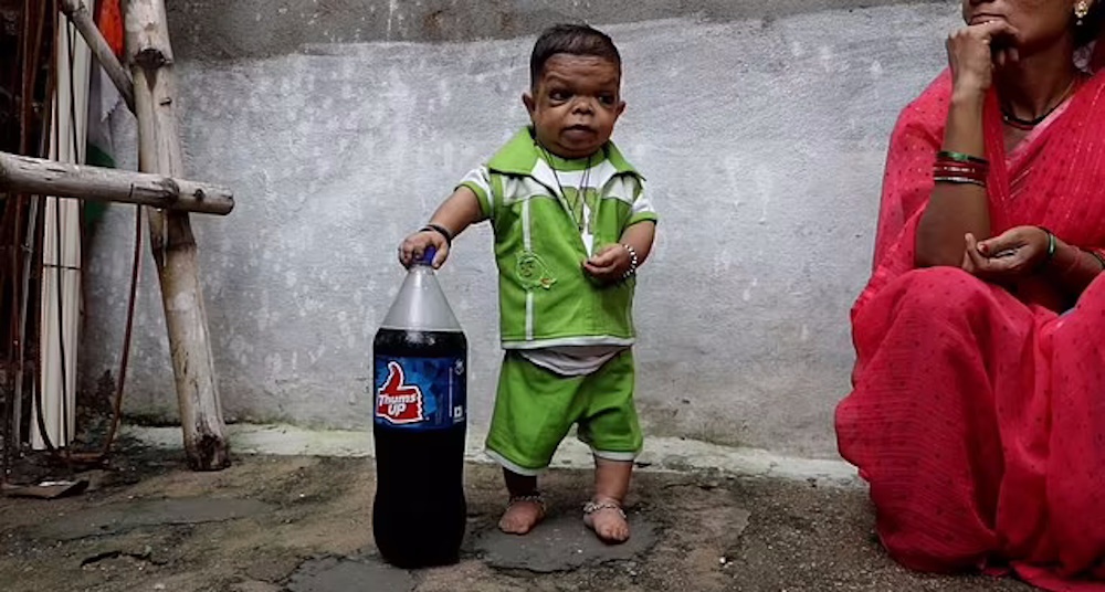 مرد ۶۰ سانتیمتری هندی که از ۵ سالگی دیگر رشد نکرد و تنها ۷ کیلو وزن دارد