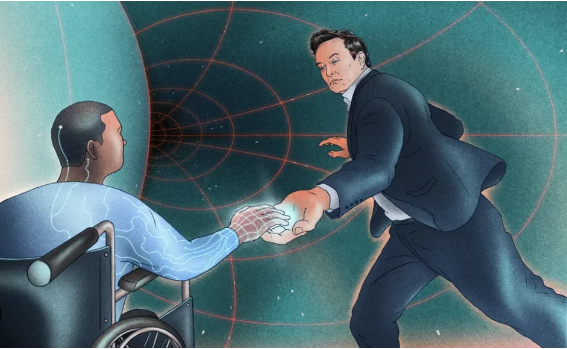 اولین ایمپلنت مغزی نورالینک در انسان دچار مشکل شد