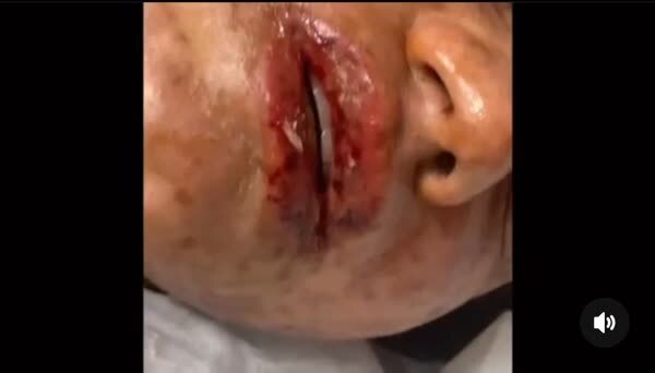 وزارت بهداشت: پزشکان عمومی تیغ زیبایی را زمین بگذارند!