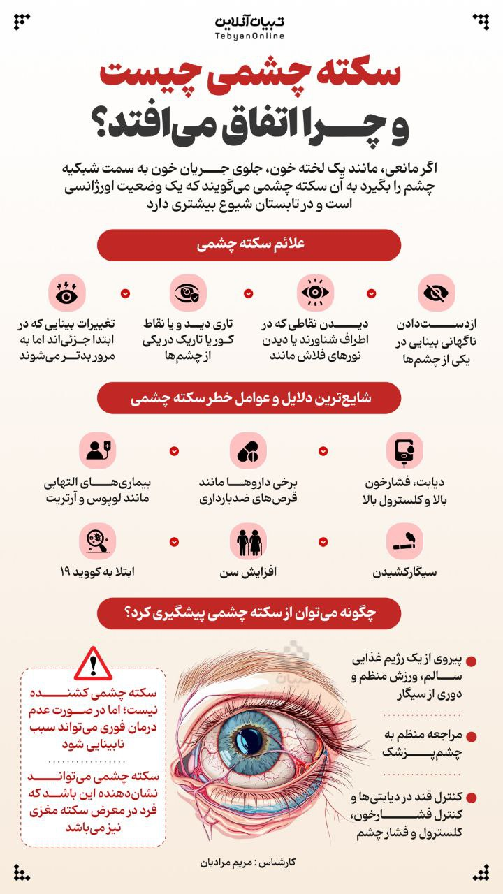 (اینفوگرافیک) سکته چشمی چیست و چرا اتفاق می‌افتد؟