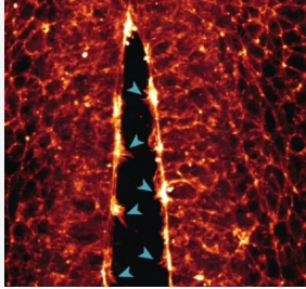 (ویدئو) ثبت تصویری بی‌سابقه از شکل‌گیری جنین؛ امیدی برای حل معماهای پزشکی
