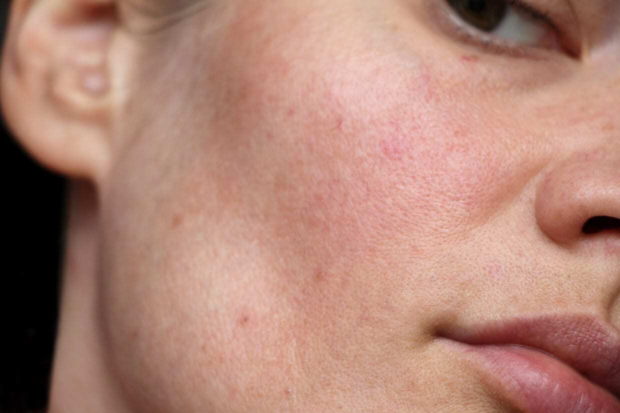 این مراقبت‌های پوستی خانگی در واقع برعکس عمل می‌کنند! / ترجمه