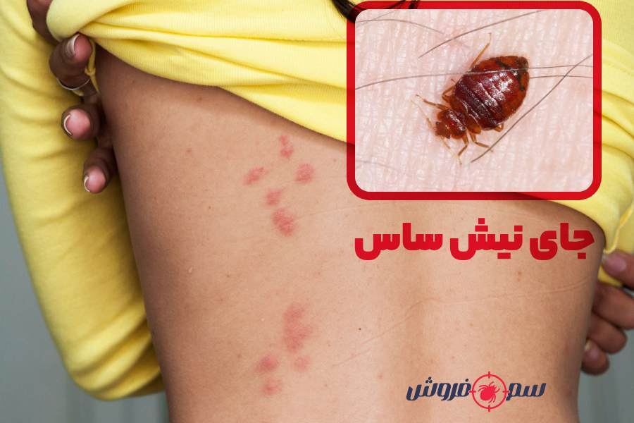علائم ساس در منزل چیست؟ و معرفی بهترین سم ساس